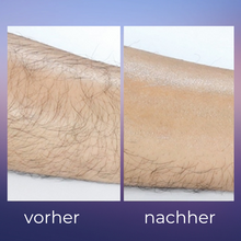 Lade das Bild in den Galerie-Viewer, Crystalline Rubber™